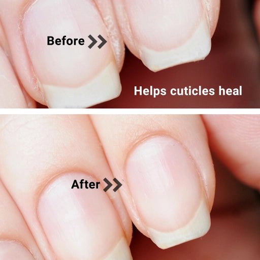 Before and After showing cuticles dry & chapped and than healthy