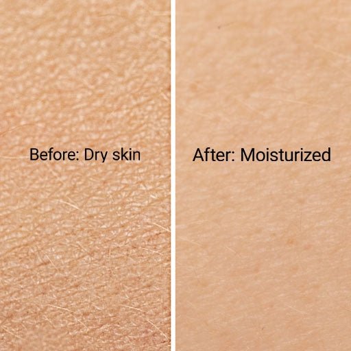 Before and after photos of dry skin and moisturized skin close up for our hydrating body cream product page.