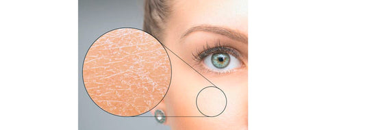 Skin hydration, the top 10 warning signs that your skin is thristy for hydration and what you can do about it.
