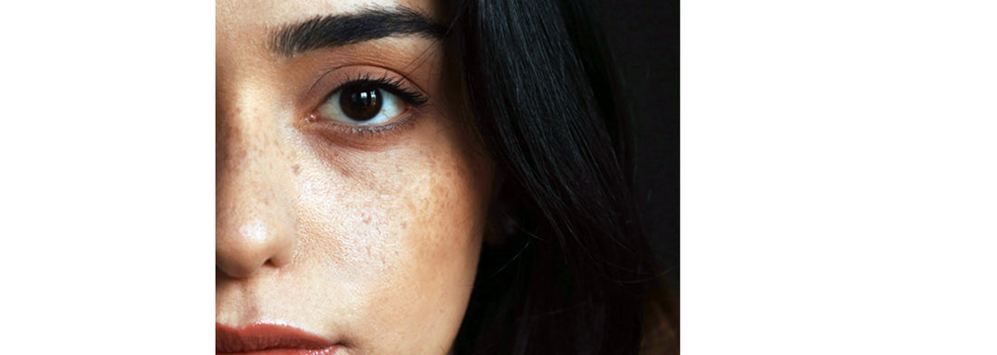 Close up of a womans face croppe in half for YASOU blog post called "Good-Bye Dark Spots & Hyperpigmentation".
