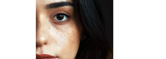 Close up of a womans face croppe in half for YASOU blog post called "Good-Bye Dark Spots & Hyperpigmentation".
