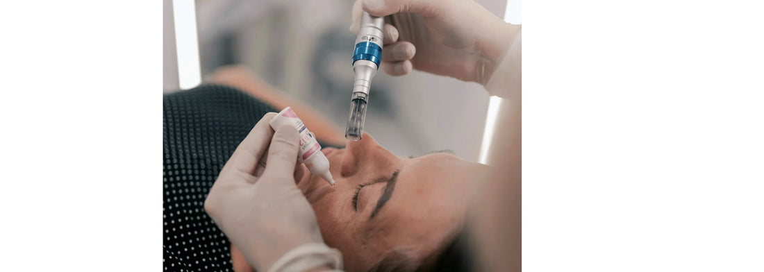 Person receiving a facial injection with a syringe in a clinical setting. Procedure is called microneedling.