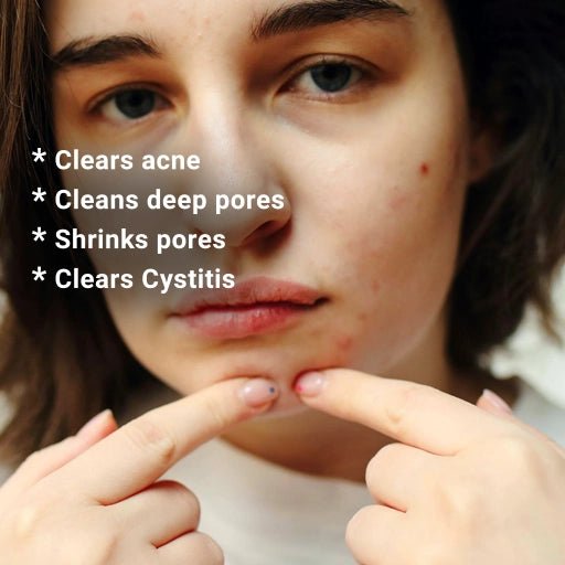 Person pointing to acne on their face with text about skincare benefits.