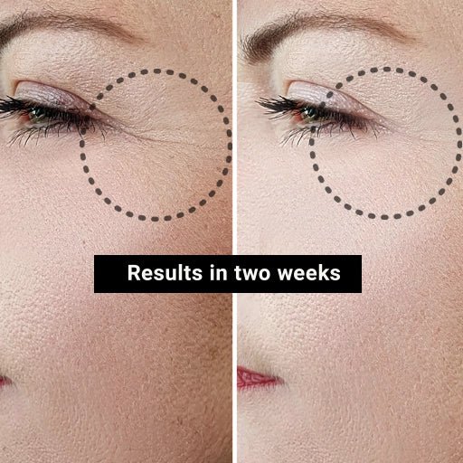 Before and after comparison of eye area with text 'Results in two weeks' on a beige background.